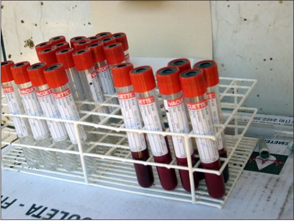 Amostras de sangue acondicionadas em tubos para exame de brucelose