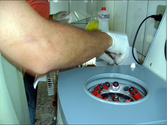 Máquina para centrifugação do sangue