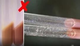 Teste alizarol instável