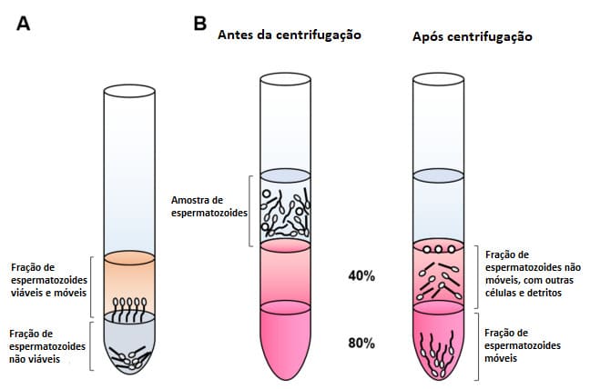 Ilustração dos espermatozoides móveis antes de depois da centrifugação