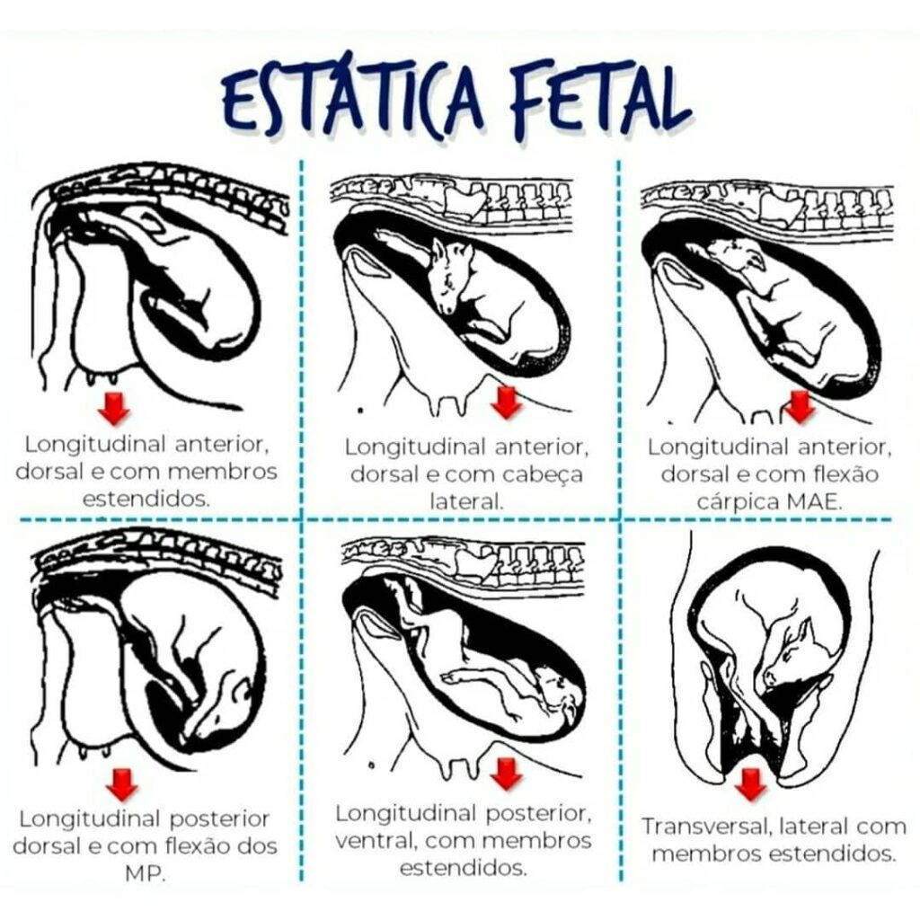 Exemplos de estática fetal