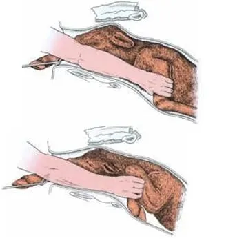 Manobra de extensão