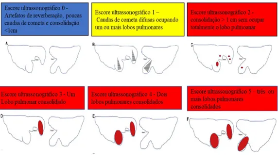 Ilustração com a explicação de cada nível do escore ultrassonográfico
