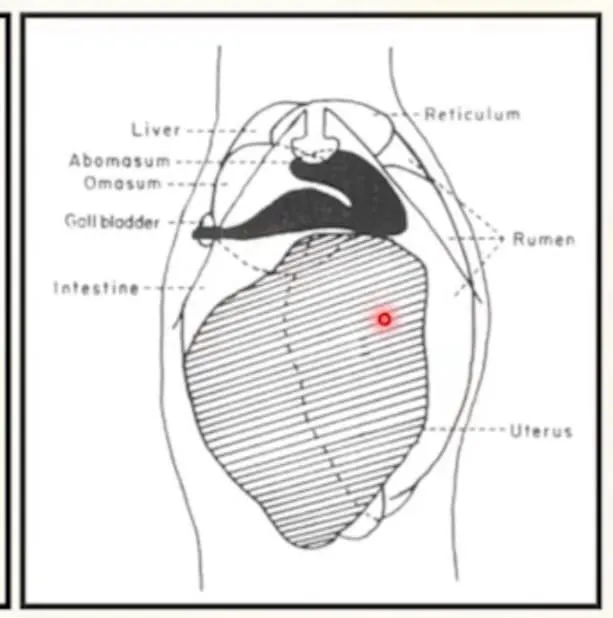 Útero gravídico (linhas tracejadas) comprimindo toda cavidade abdominal