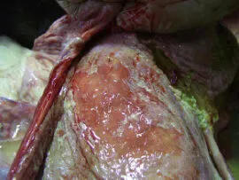 Espessamento da parede abomasal e erosão da mucosa e submucosa