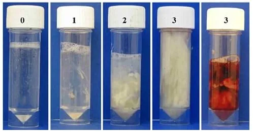 Escores de avaliação da descarga vaginal