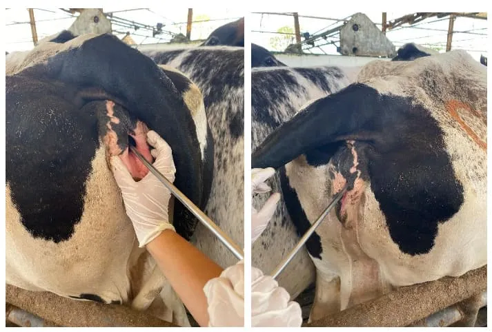 Metricheck para avaliação do conteúdo uterino