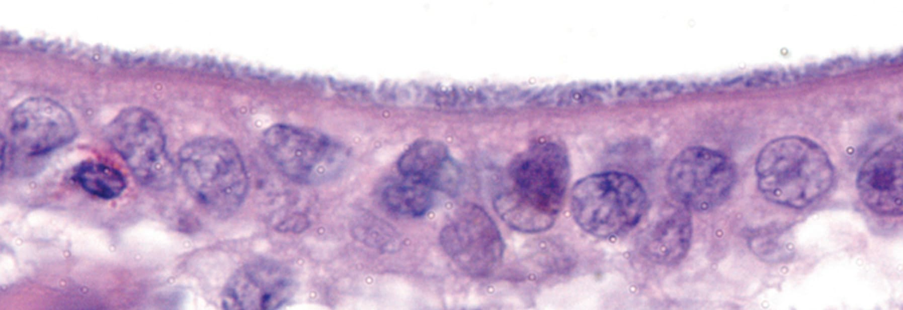 Colonização da Mucosa na Colibacilose Entérica
