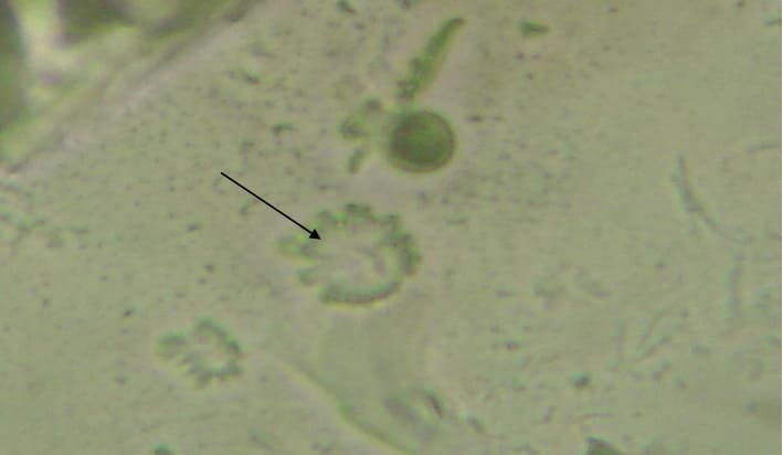 Material purulento de actinobacilose