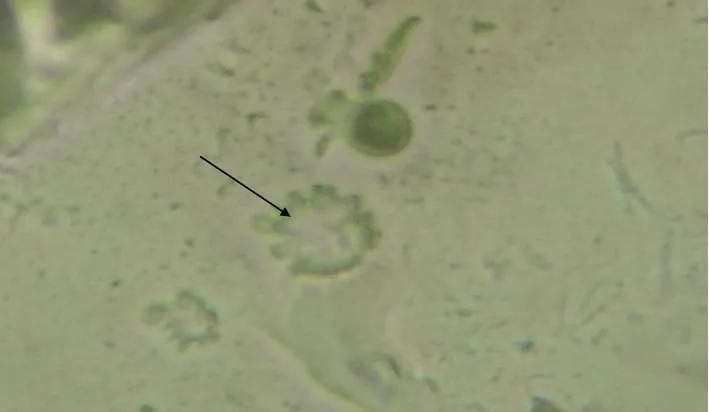 Material purulento de actinobacilose